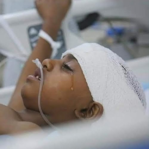 Photo de Rouweida à l'hôpital Photo de Rouweida à l'hôpital au Yémen